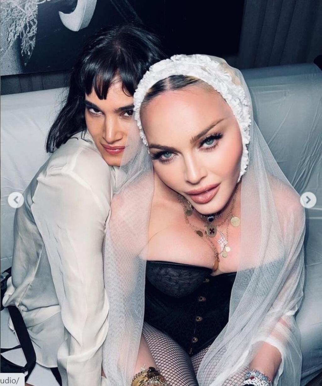 Madonna má na svojich fotografiách vyretušovanú tvár.