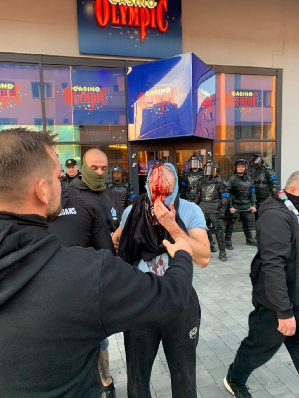 Výsledkom toho boli rozbité hlavy, tržné rany a dokonca dvaja z nich boli na pár okamihov v bezvedomí.