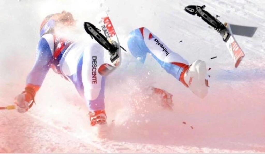 Rakúsky lyžiar Matthias Länzinger na olypijských hrách v Sochi 2014 utrpel vážne zranenie, ktoré malo ešte horšie následky.