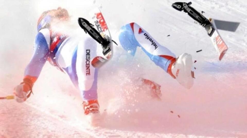 Rakúsky lyžiar Matthias Länzinger na olypijských hrách v Sochi 2014 utrpel vážne zranenie, ktoré malo ešte horšie následky.