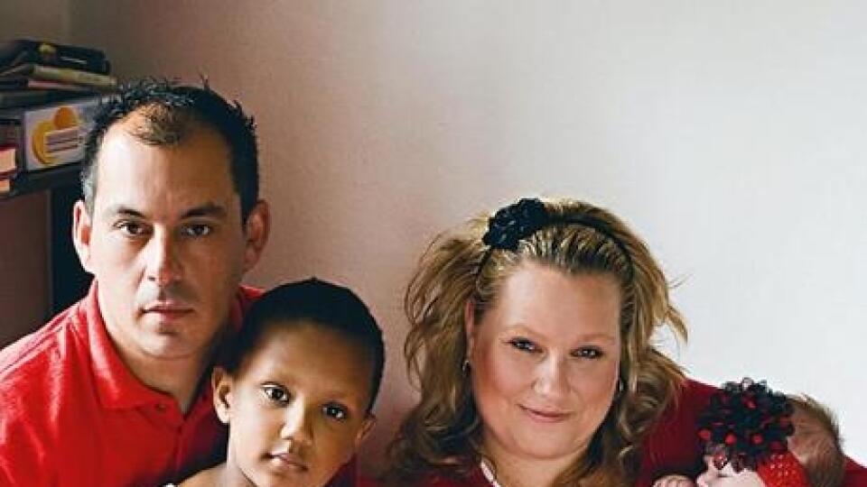 Jasminka sa narodila so zriedkavou diagnózou, ktorá si len za prvý mesiac jej života vyžiadala štyri operácie.