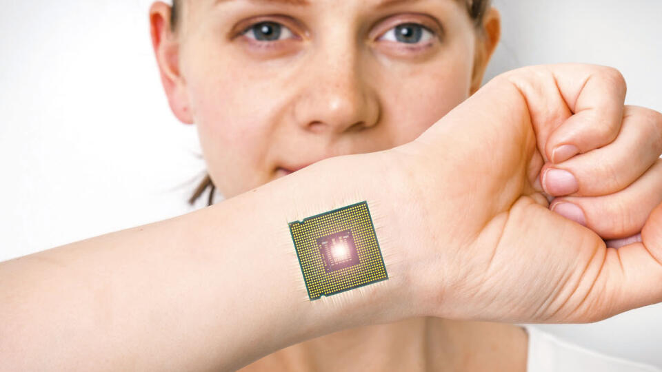 Bionic chip (processor) implant in female human body - future technology and cybernetics concept, Image: 379101007, License: Royalty-free, Restrictions: , Model Release: yes, Credit line: Profimedia, Depositphotos Inc.