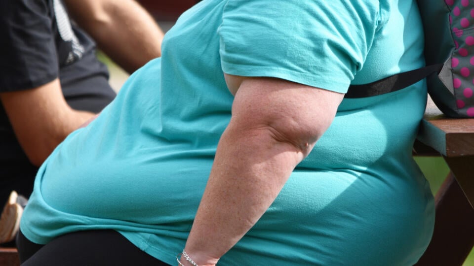 Hampshire,,Uk,Sept,15,2018.,A,Morbidly,Obese,Woman,Sits