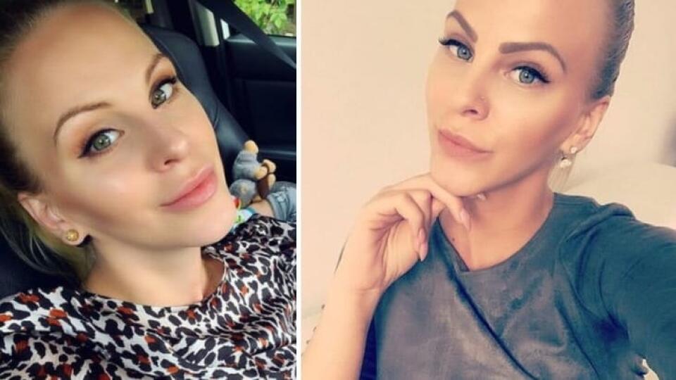 Barbora Balúchová sa už totálne zmenila na umelú bábiku.