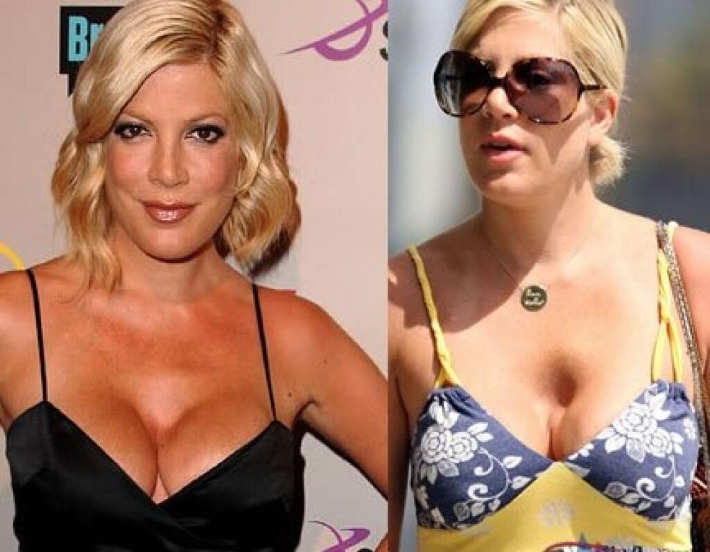 Breast Size बढाने का सबसे तेज नुस्खा गारंटी के साथ How To Increase Breast Size N
