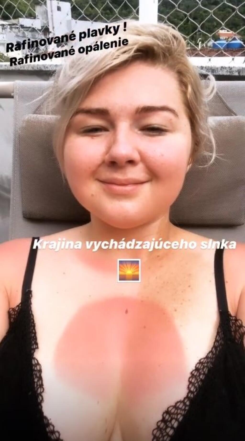 Evelyn na druhý deň ukázala opálenie podľa plaviek.