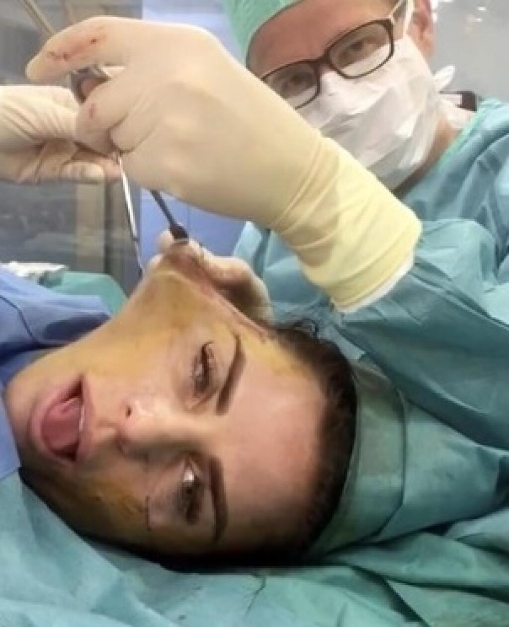 Anglická sexbomba má za sebou množstvo plastických operácií, pri ktorých si nechala upraviť snáď všetky časti tela. Zábery