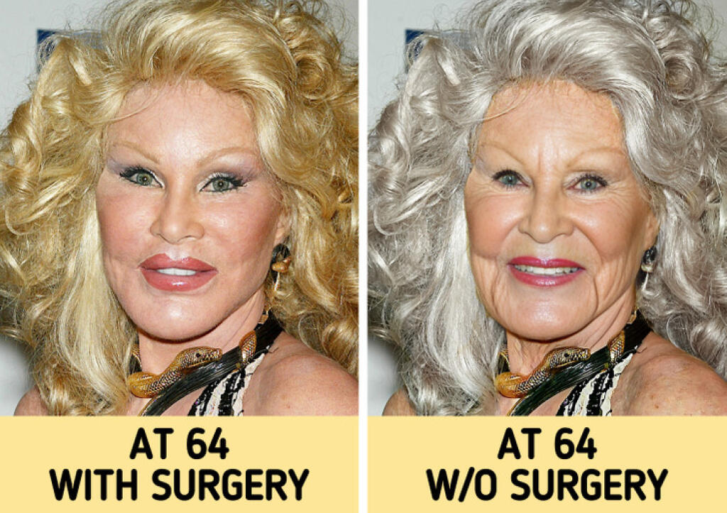 Jocelyn Wildenstein