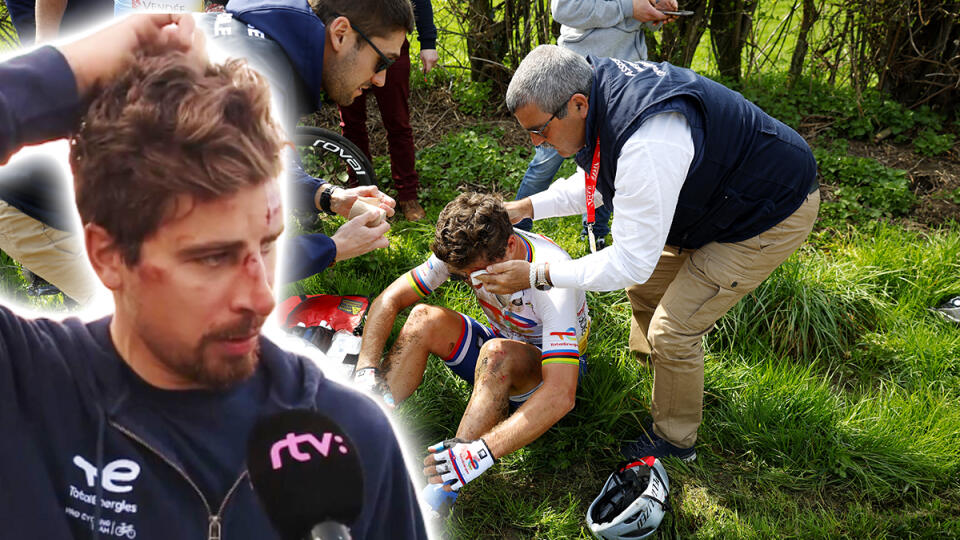 Dopadlo to inak, ako si predstavoval. Peter Sagan preteky Paríž-Roubaix nedokončil a pohľad na neho po prepustení z nemocnice poriadne bolel.