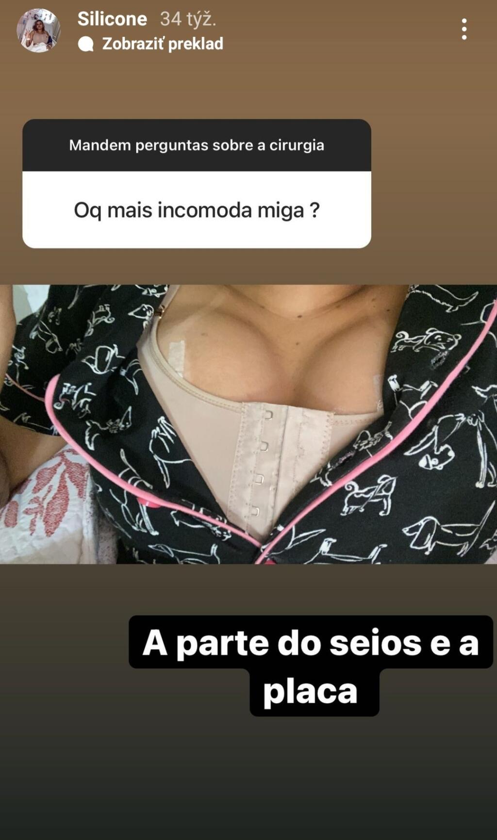 Dokonca aj na Instagrame sa pýšila tým, že má silikóny a s pocitmi z operácie sa delila s fanúšikmi.
