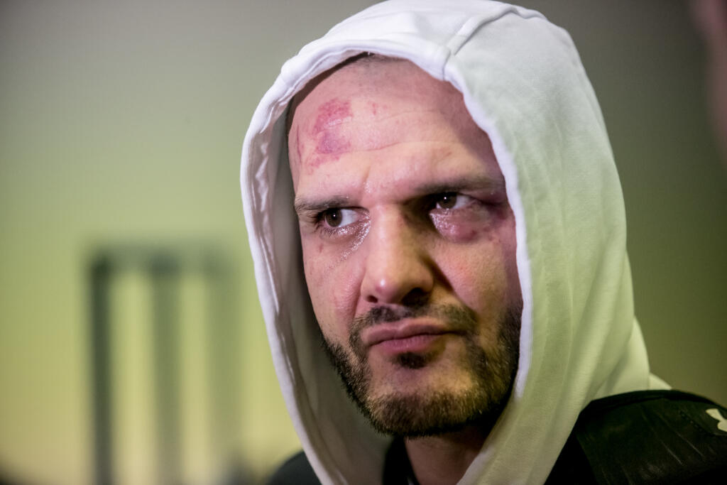 FOTO Rytmus má za sebou boxerský zápas! Takto ste ho ešte nevideli: Zaliaty krvou a totálne na dne!