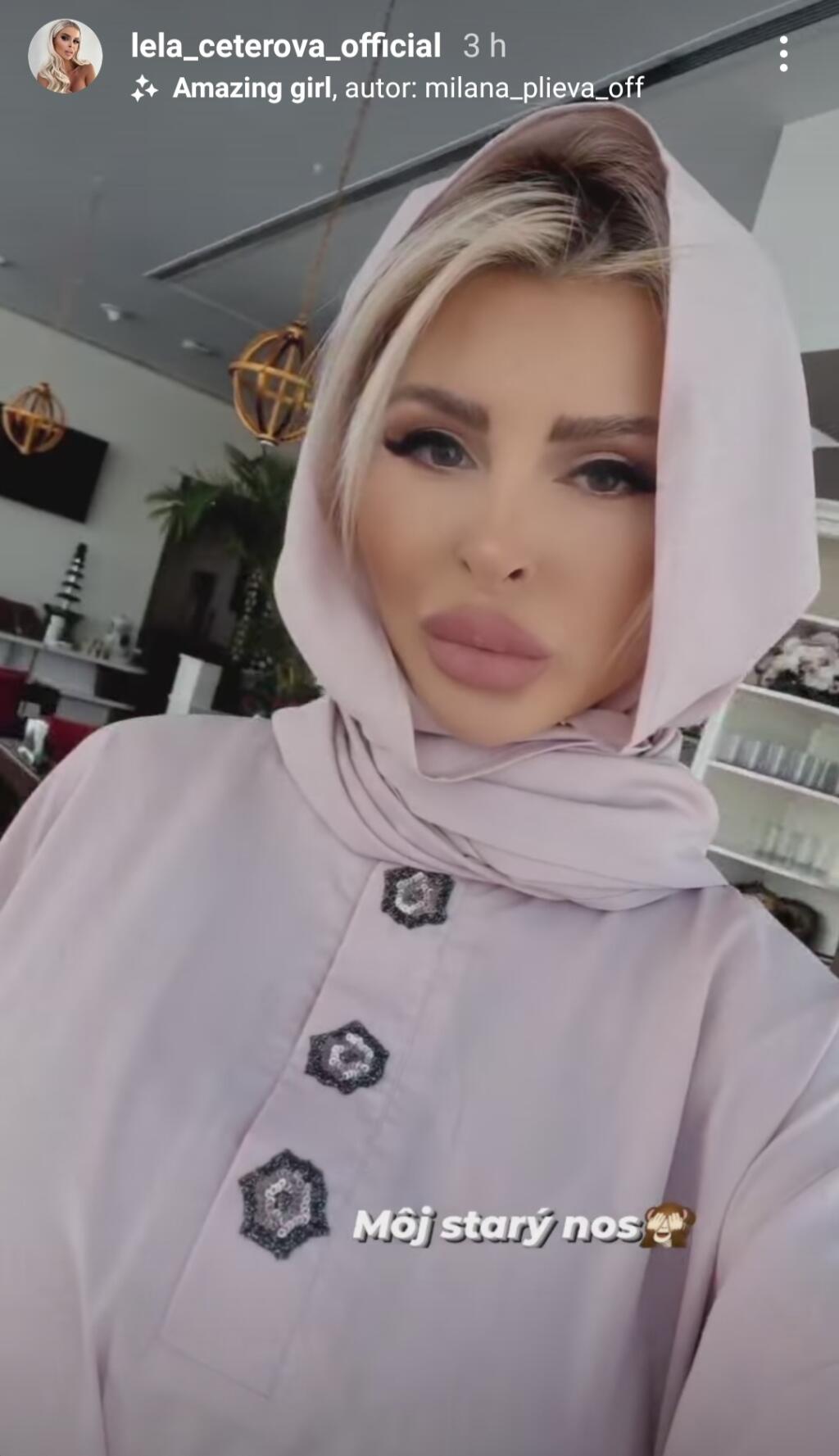 Lela Ceterová sa pre svojho manžela snaží byť čo najkrajšou a preto sa nedávno nechala vylepšiť až v Iráne.