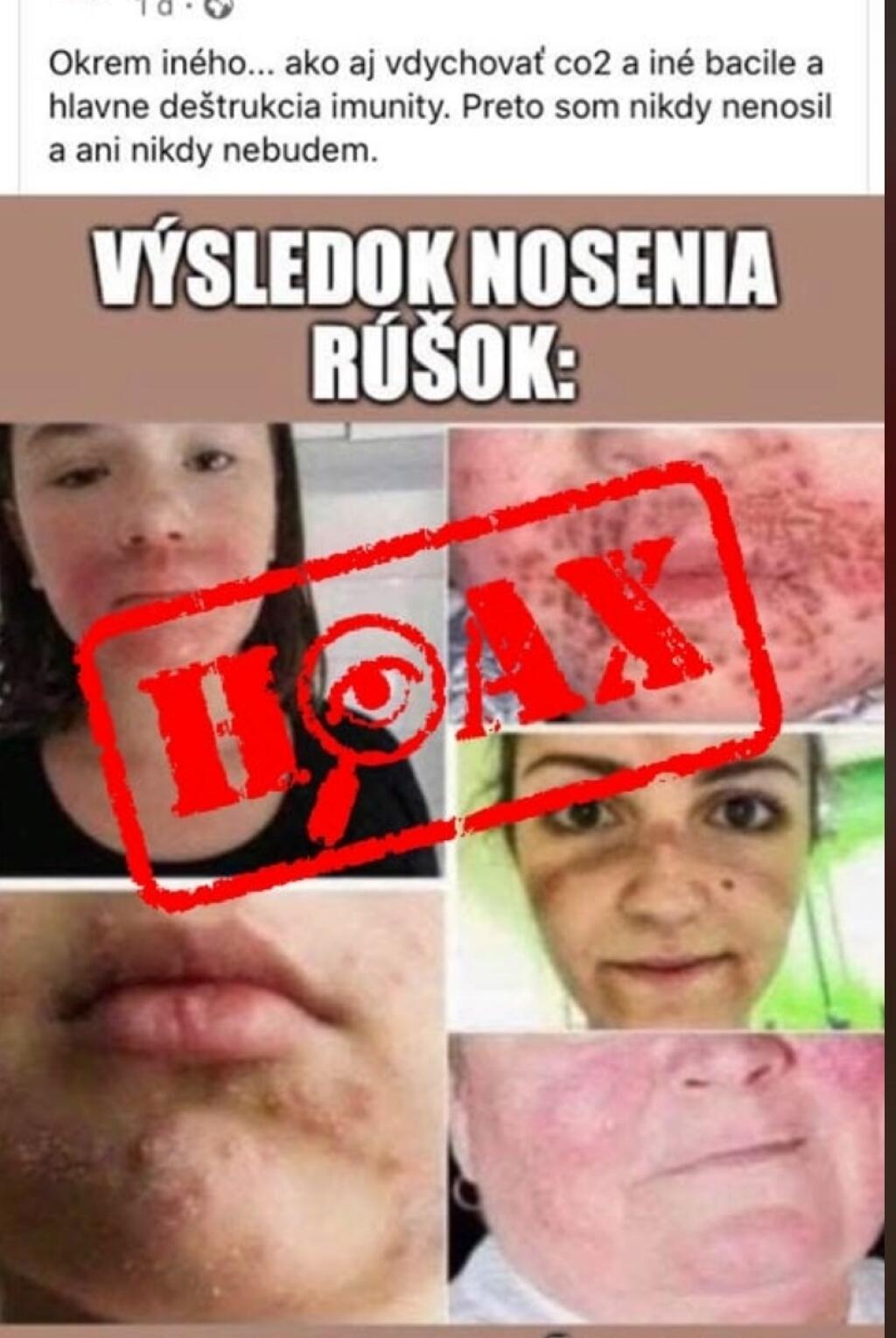 NEBEZPEČNÉ RÚŠKA? Existuje množstvo hoaxov o tom, že rúška vážne poškodzujú zdravie. Pozor však, aby takýto status nebol poplašnou správou!