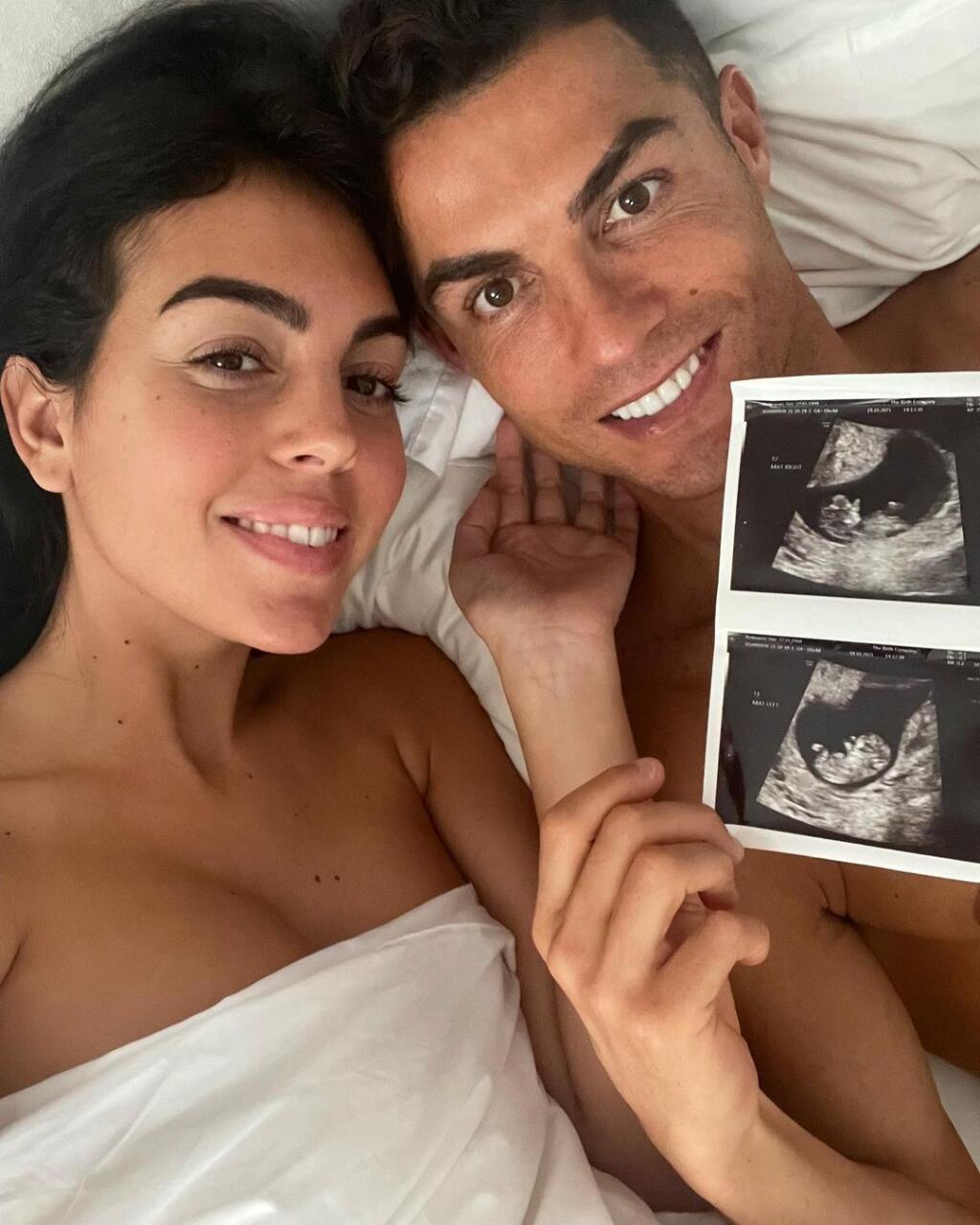 Prominentný pár sa na nové prírastky tešil, ale počas pôrodu prežilo len dievčatko. Georgina o tragickej udalosti prehovorila prvýkrát.