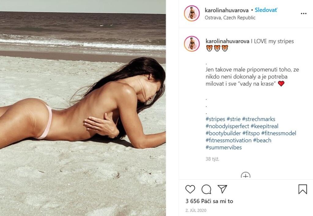 Napriek tomu, že mnohé ženy strie schovávajú, Huvarová si z nich ťažkú hlavu nerobí. „Nikto nie je dokonalý a je potrebné milovať aj svoje „vady na kráse“,“ vyhlásila.