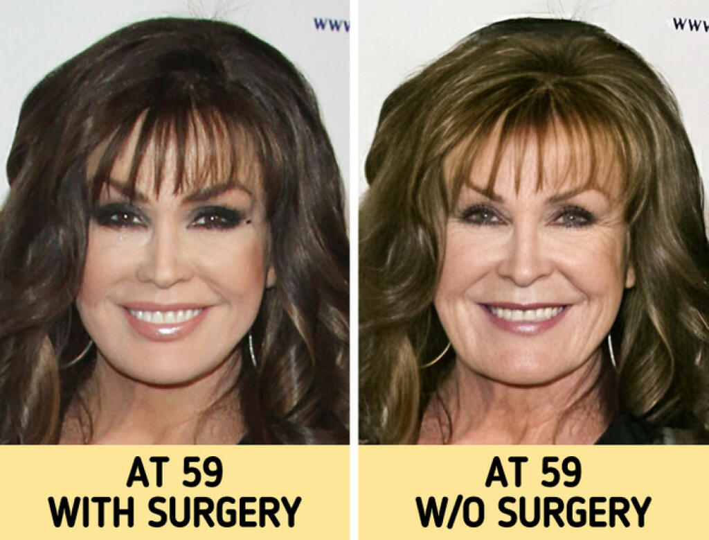 Marie Osmond