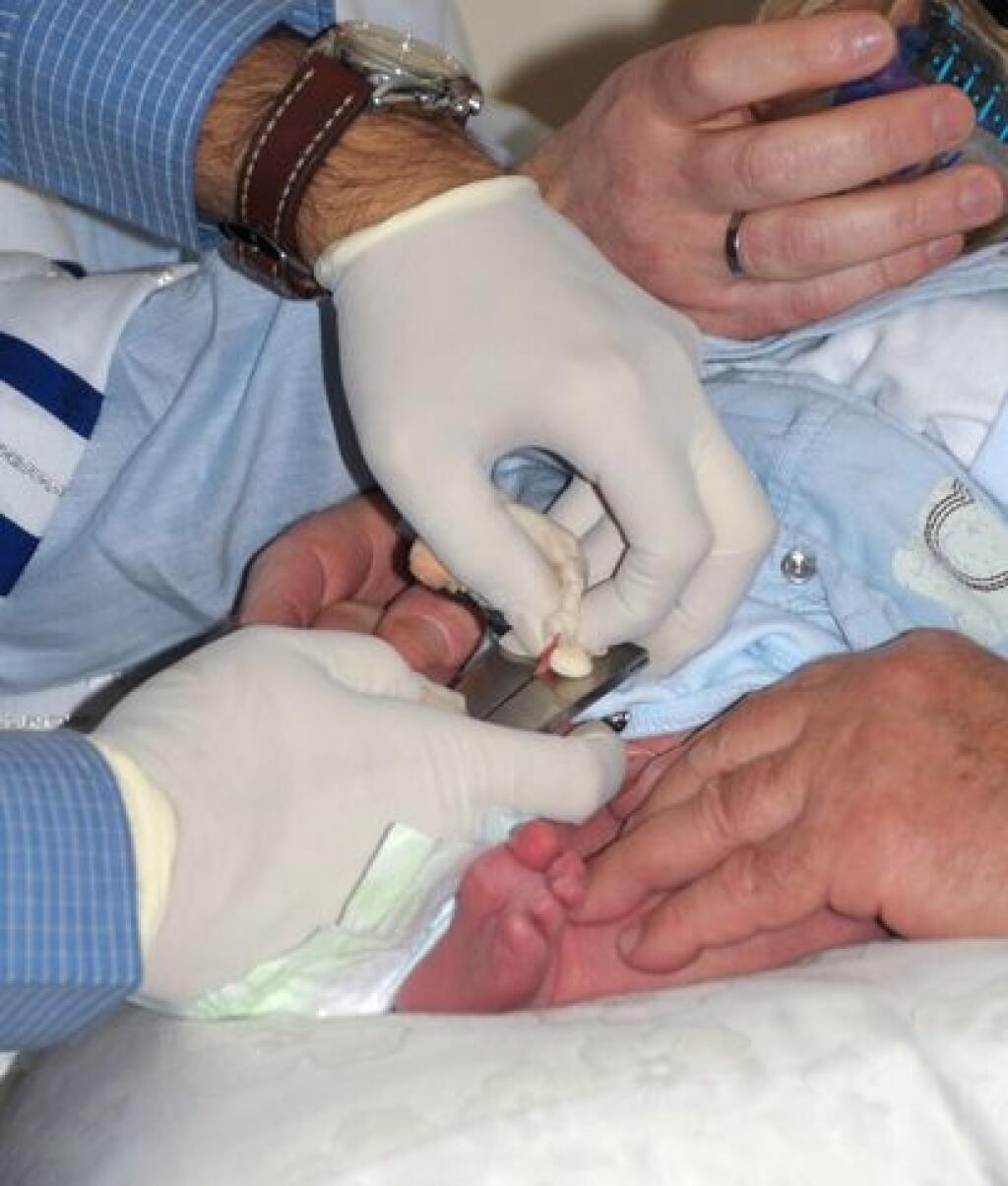 Iceland wants to ban circumcision