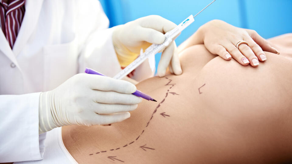 Liposukcia je operačný zákrok, pri ktorom sa používa adrenalín. Ten môže byť pre srdce záťažou.