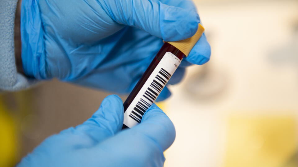 Spoločnosť Alpha Medical testuje sérum z odobratej krvi pacienta na prítomnosť koronavírusu COVID-19