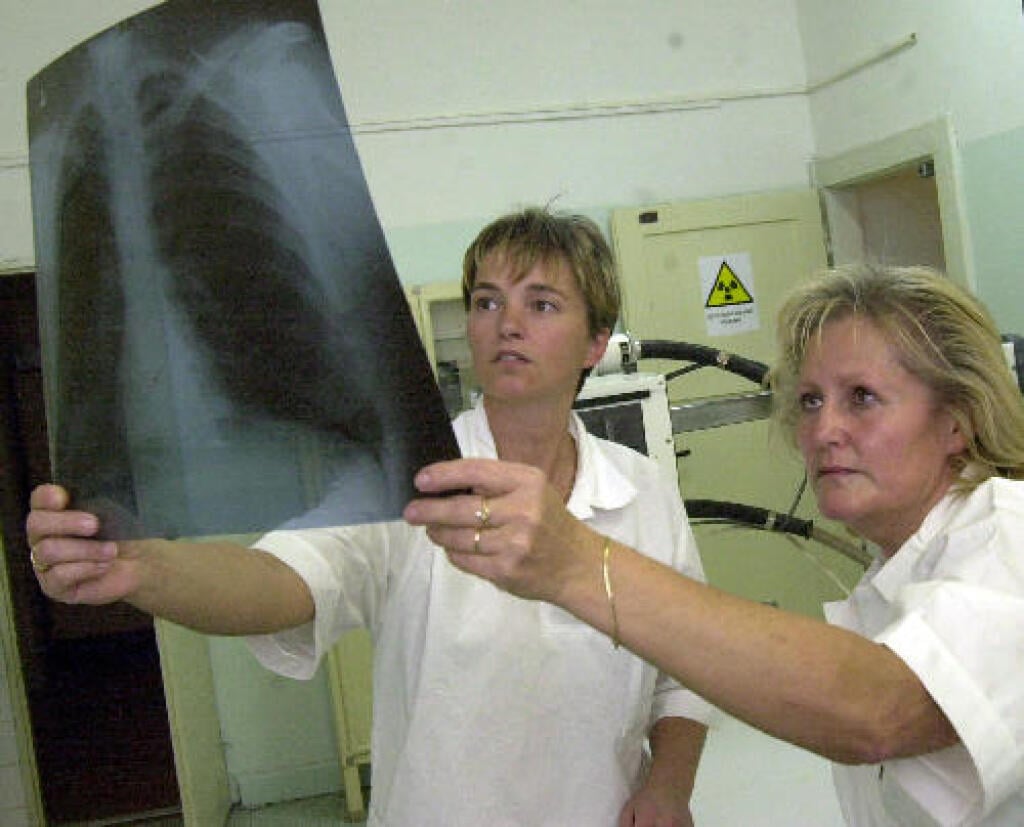 On October 21, Blanka Pätnická (left) and Anna Hlušková examined the technical quality of an X-ray of the lungs of one of the teachers at the 5th primary school in Myslbekova Street, where an infectious tuberculosis in one of the seventh graders.  The 15-year-old pupil is being admitted to the lung ward of Karlovy Vary Hospital, and her entire family is under medical supervision.  Full teaching staff of the school and about 80 