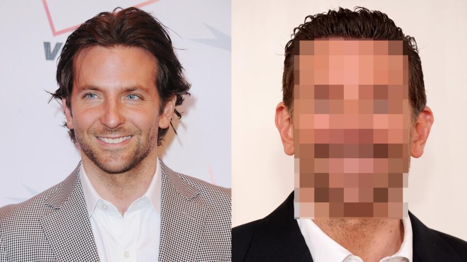 Čaru estetickej chirurgie nepodľahnú iba ženy, ale aj muži. Jedným zo smutných prípadov je jeden z najviac vyhľadávaných hollywoodskych hercov Bradley Cooper (49). Síce žiadny zákrok otvorene nepriznal, každému je jasné, že charizmatický herec sa na seba už vôbec nepodobá.