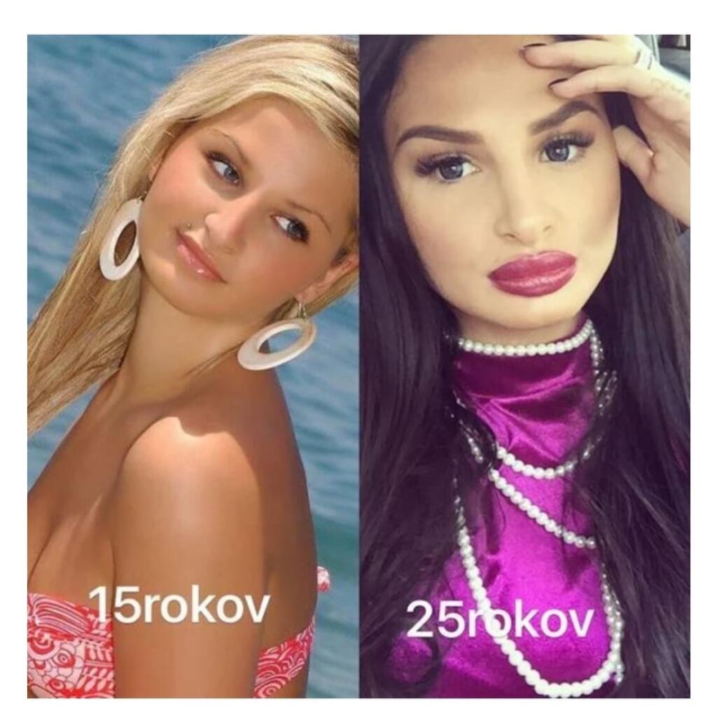 Plačková pred rokmi. Kedy vyzerala lepšie?