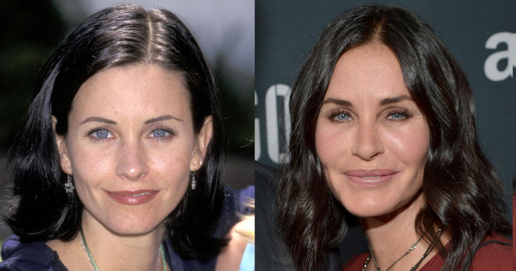 Courtney Cox pred a po plastikách.