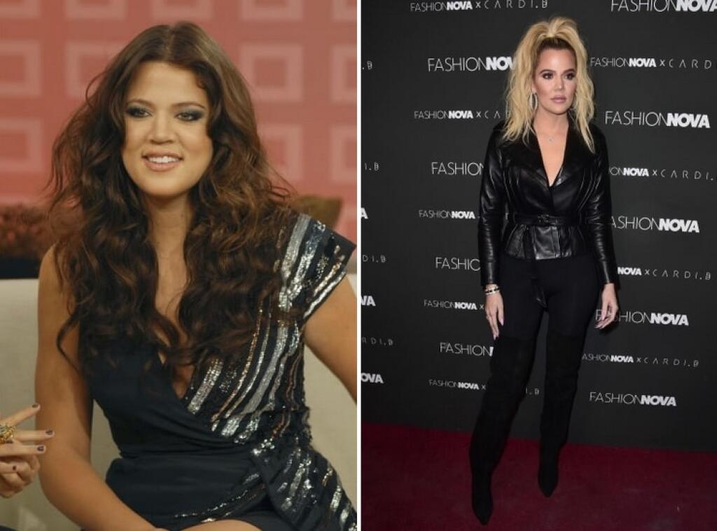 Khloé Kardashian