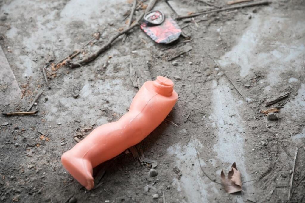 V liečebni sa nachádzajú aj časti hračiek.