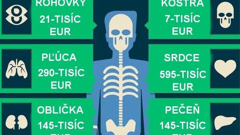 Koľko Stoji ľudske Telo Pozrite Si Infografiku