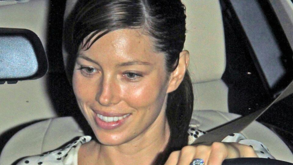 Jessica Biel a jej veľmi decentný herpes. Takmer ho ani nie je vidieť.