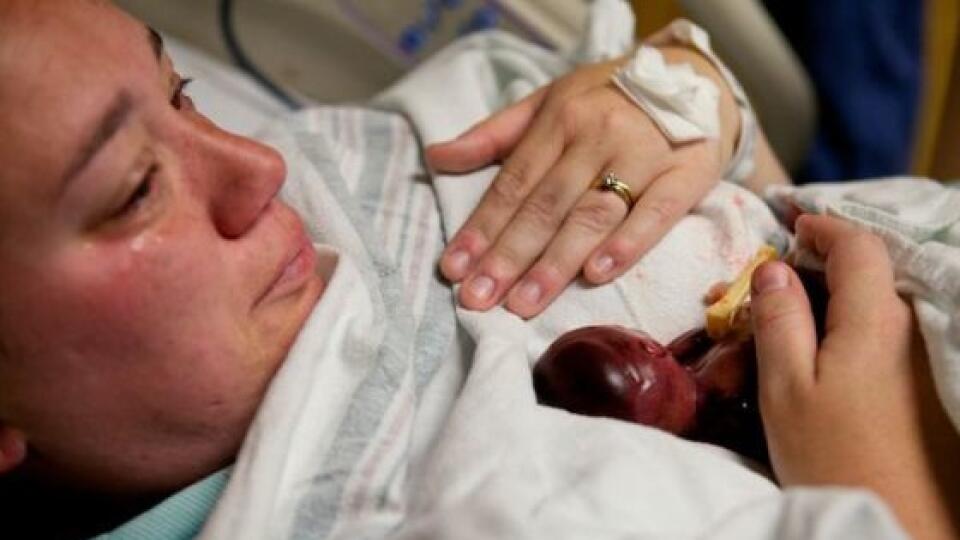 Mamička zverejnila fotky so svojím synčekom, ktorého porodila v 19-tom týždni.