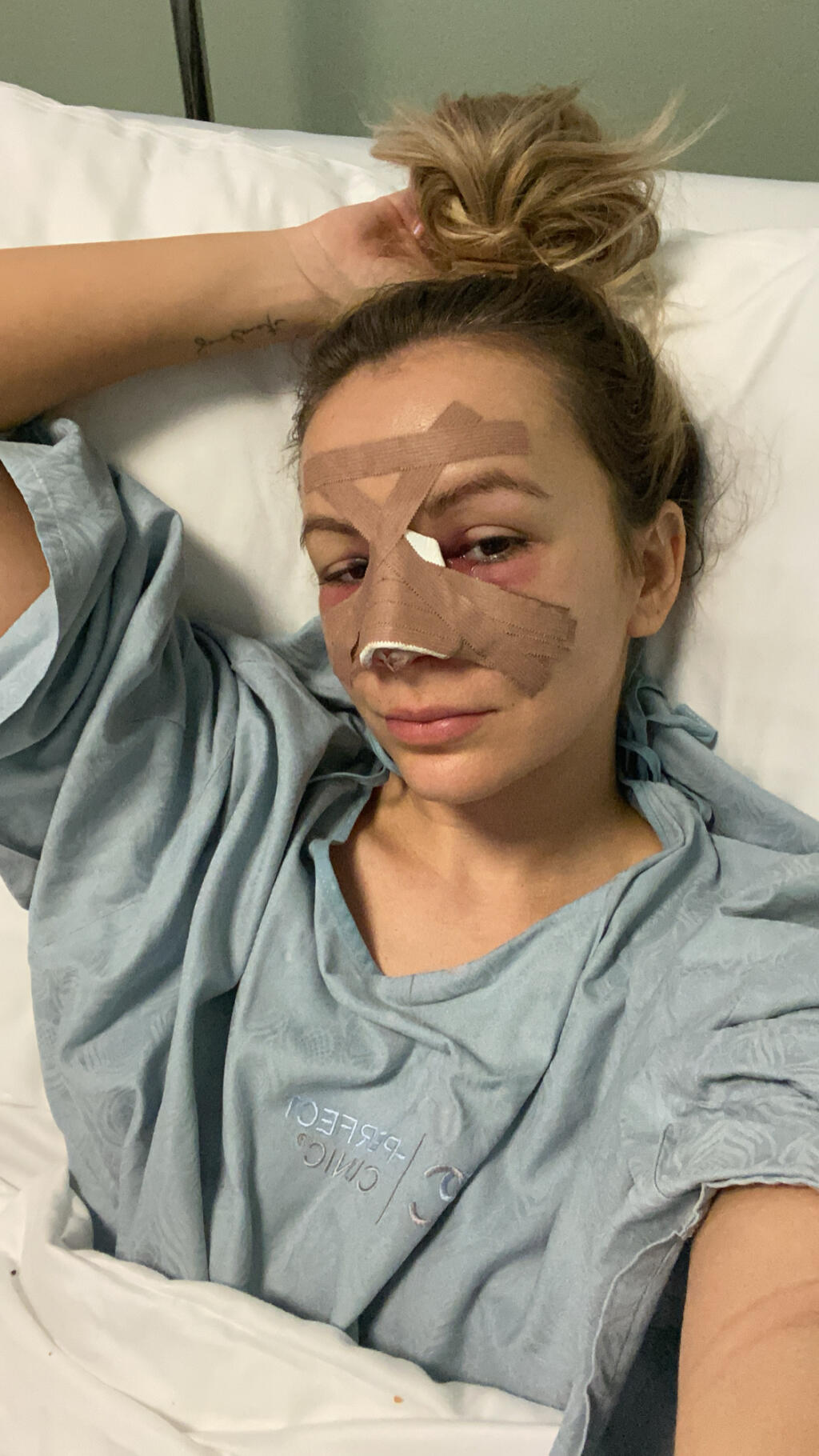 Známa česká športová influencerka Šárka Peková, ktorá navštevuje aj zápasy Fortuna ligy podstúpila pred niekoľkými dňami operačný zákrok.