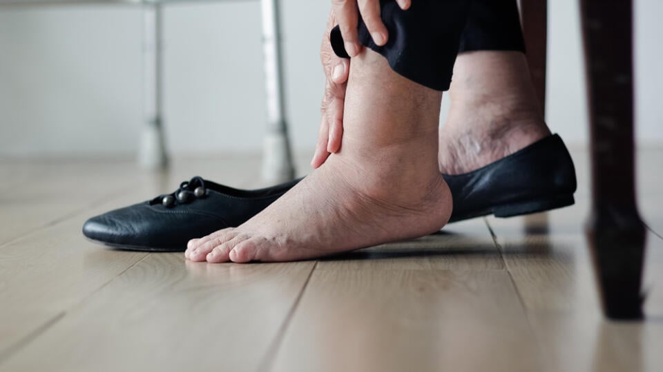 Elderly,Woman,Swollen,Feet,Putting,On,Shoes