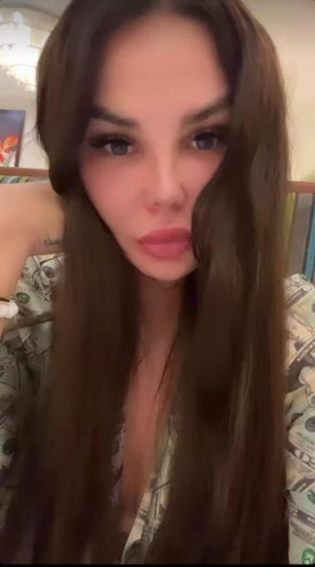 Aj keď za plastiku tváre vysolila 33-tisíc eur, Plačková musí neustále používať skrášľovacie filtre.