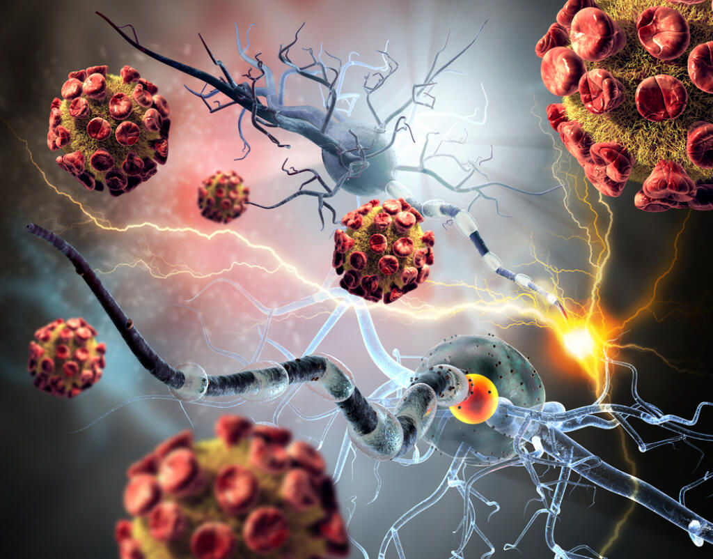 3d,Illustration,Of,Nerve,Cells.,Viruses,Attacking,Nerve,Cells,,Concept