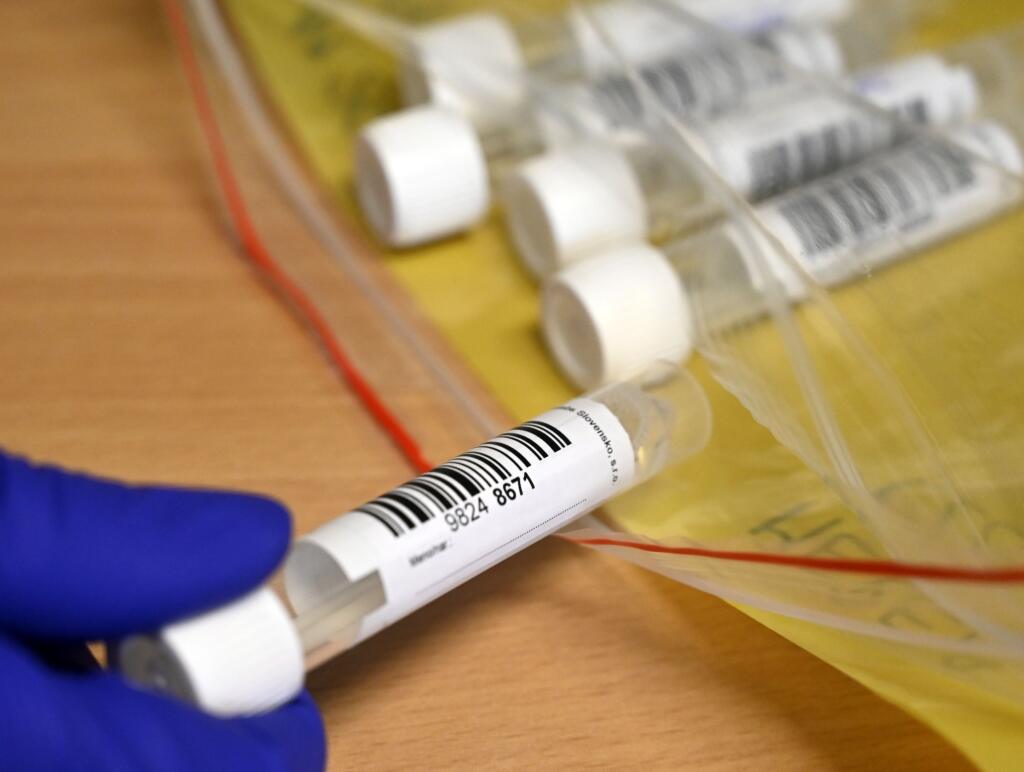 Na snímke testovanie PCR testami na prítomnosť ochorenia COVID-19 v rómskej osade v Trebišove 26. novembra 2021. FOTO TASR - Roman Hanc