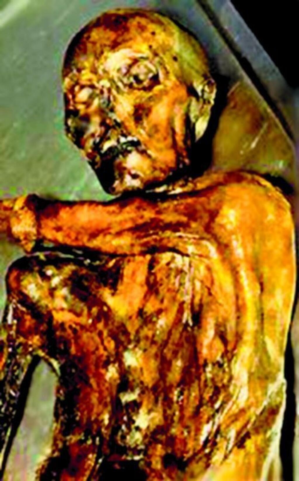 Otzi