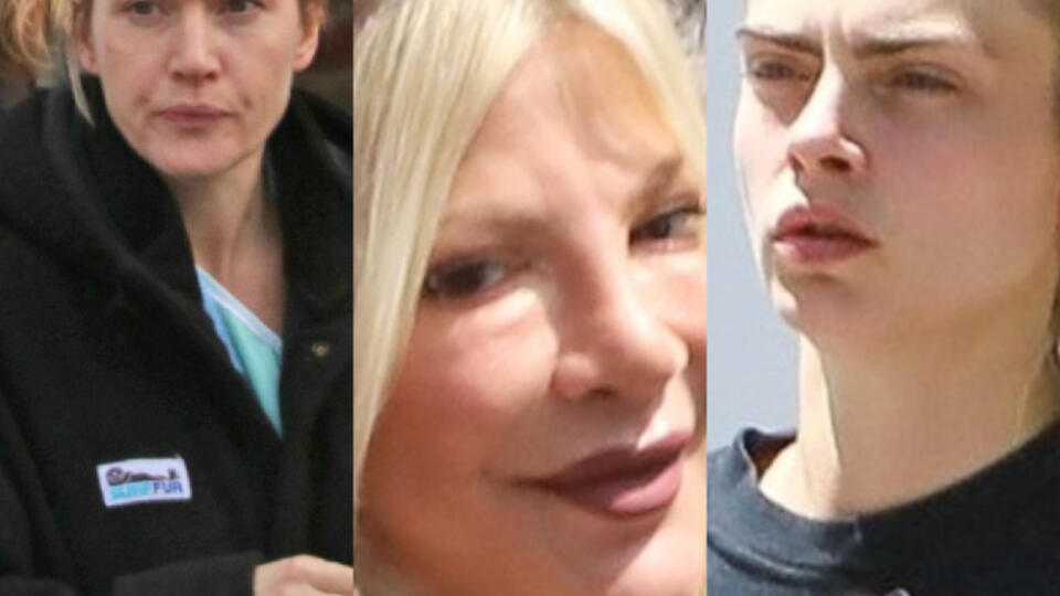 Z obálok prestížnych magazínov aj z instagramových účtov na nás každý deň pozerajú dokonalé krásky. Ich pleť je bez pórov, pupienkov či vrások, čo mnoho bežných žien občas zamrzí – že nevyzerajú tak, ako im diktujú tieto trendy krásky. Ale, hádajte čo! Realita je úplne iná.