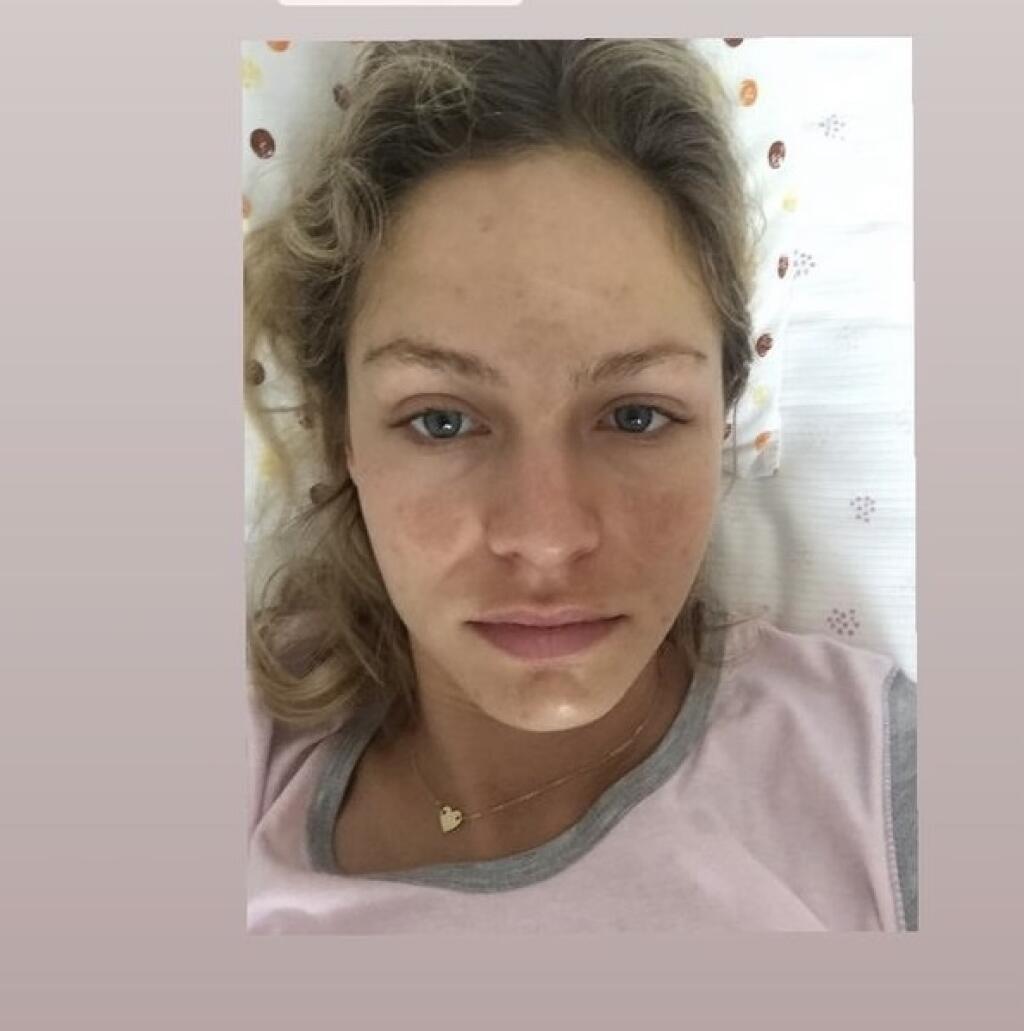 Ivana Gáborík v roku 2017 s pigmentovými škvrnami