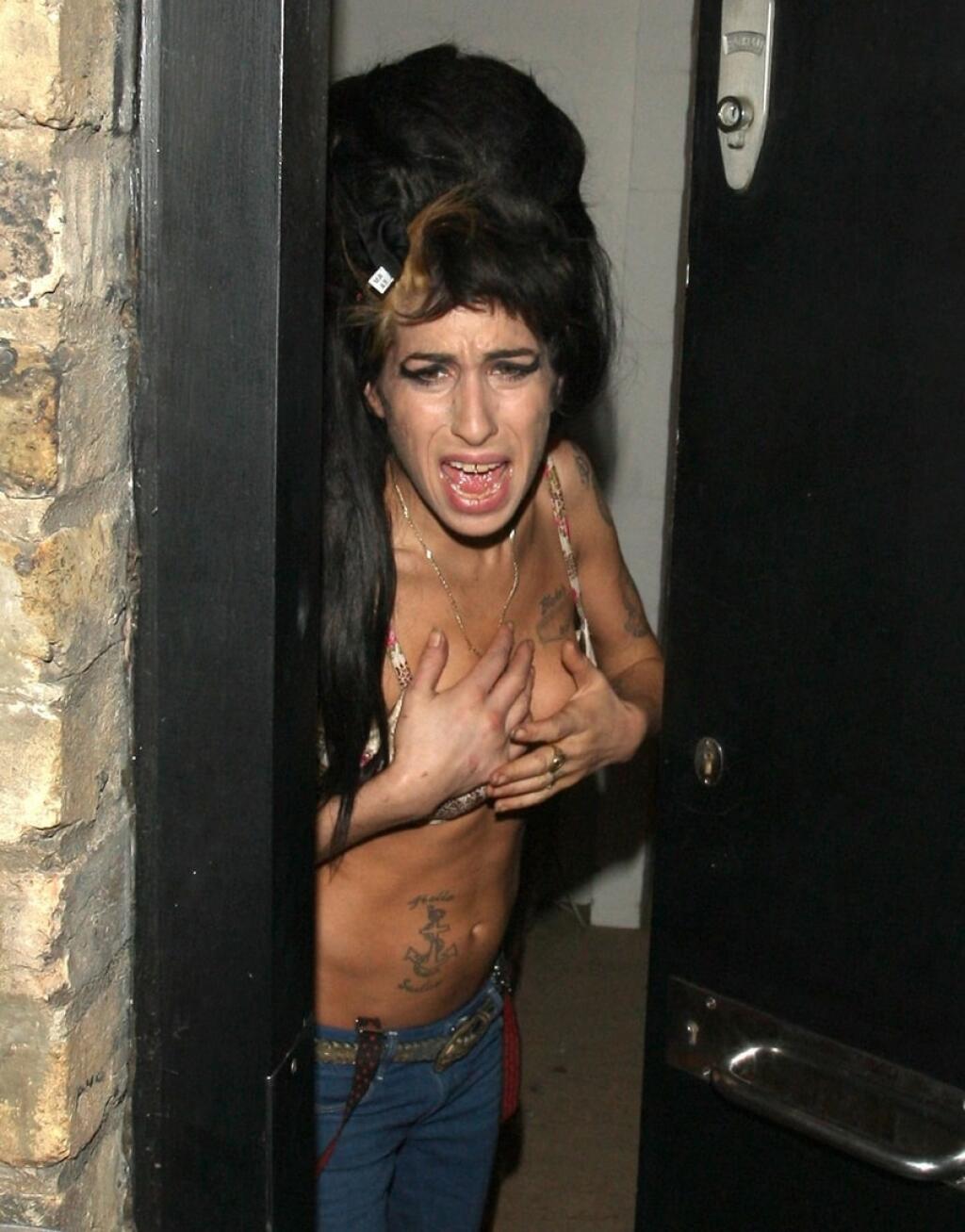 Amy winehouse autopsy pictures