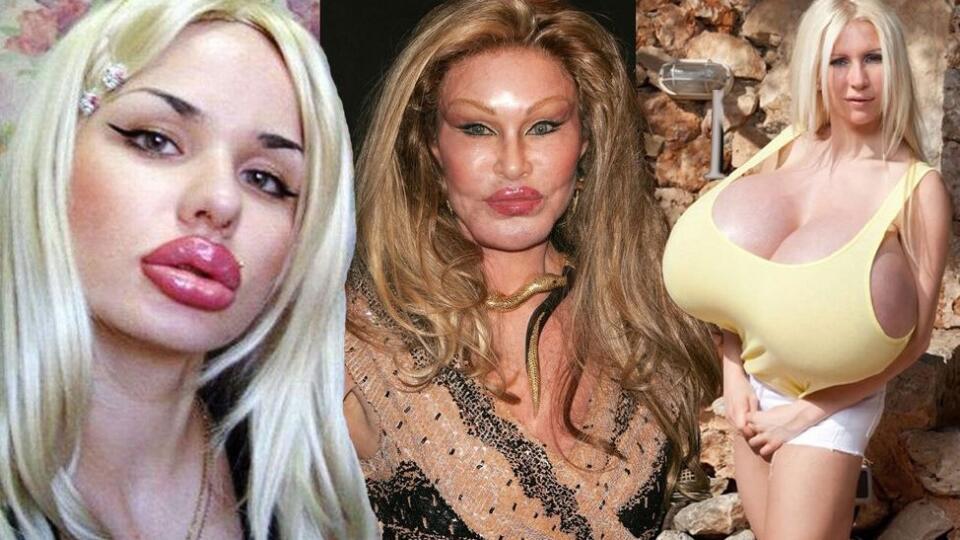 Najextrémnejšie plastiky všetkých čias: Kristina