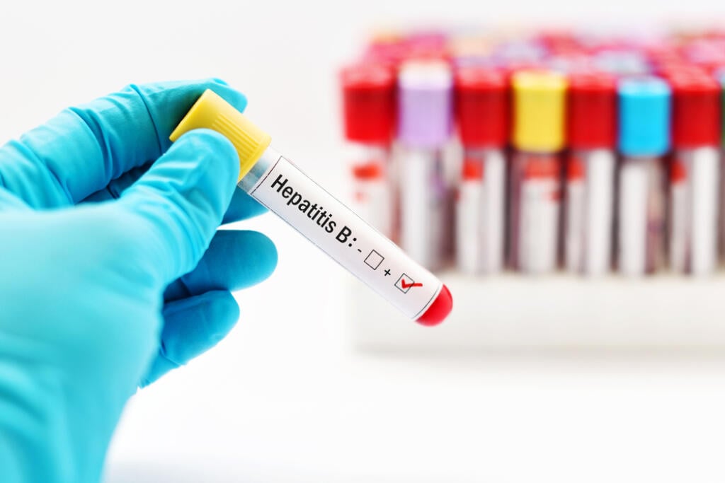 Lieky a cholesterol
Lieky na cholesterol alebo na reumu dokážu pečeň poriadne zaťažiť a časom ju poškodia. Sú známe ale aj prípady poškodenia pečene kvôli dlhodobému užívaniu antidepresív, antibiotík a liekov proti bolesti. Zvyčajne ich sprevádzajú aj problémy s obličkami.