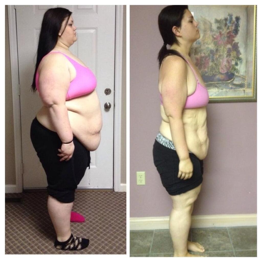 Takmer 200-kilová tínedžerka schudla o polovicu, teraz motivuje obéznych.