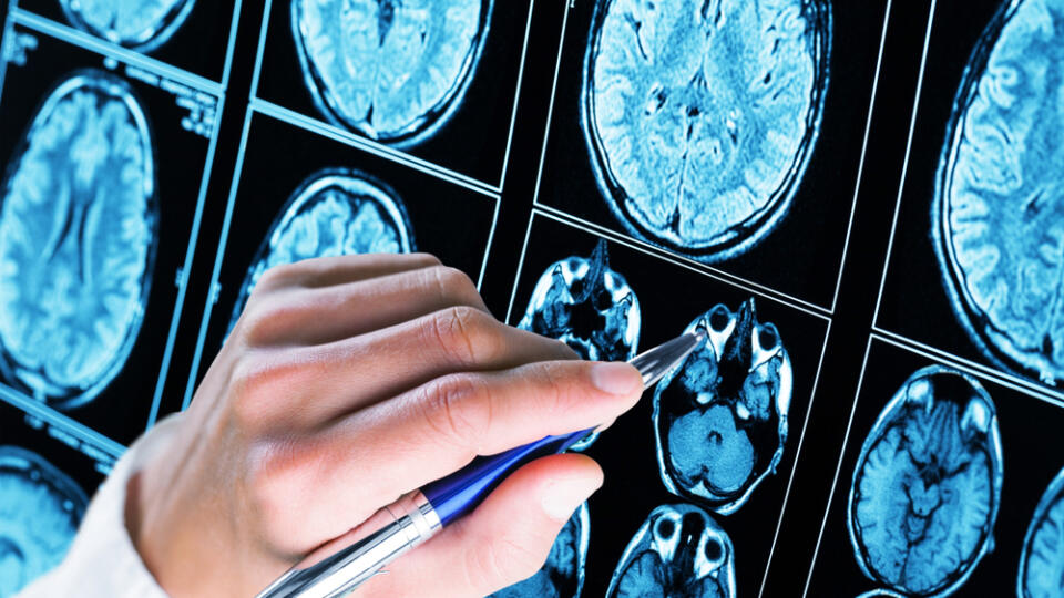 Doctor,Pointing,With,Pen,To,The,Brain