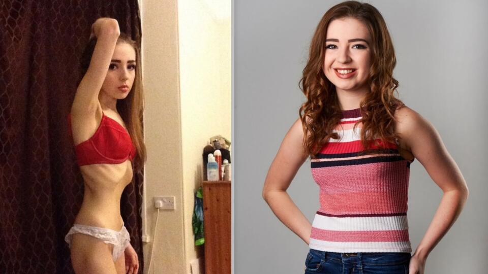 Faye vážila len 25 kilogramov.