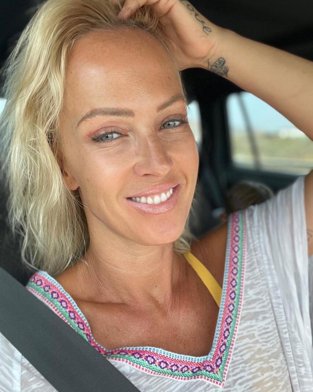 Zuzka Belohorcová po plastike.