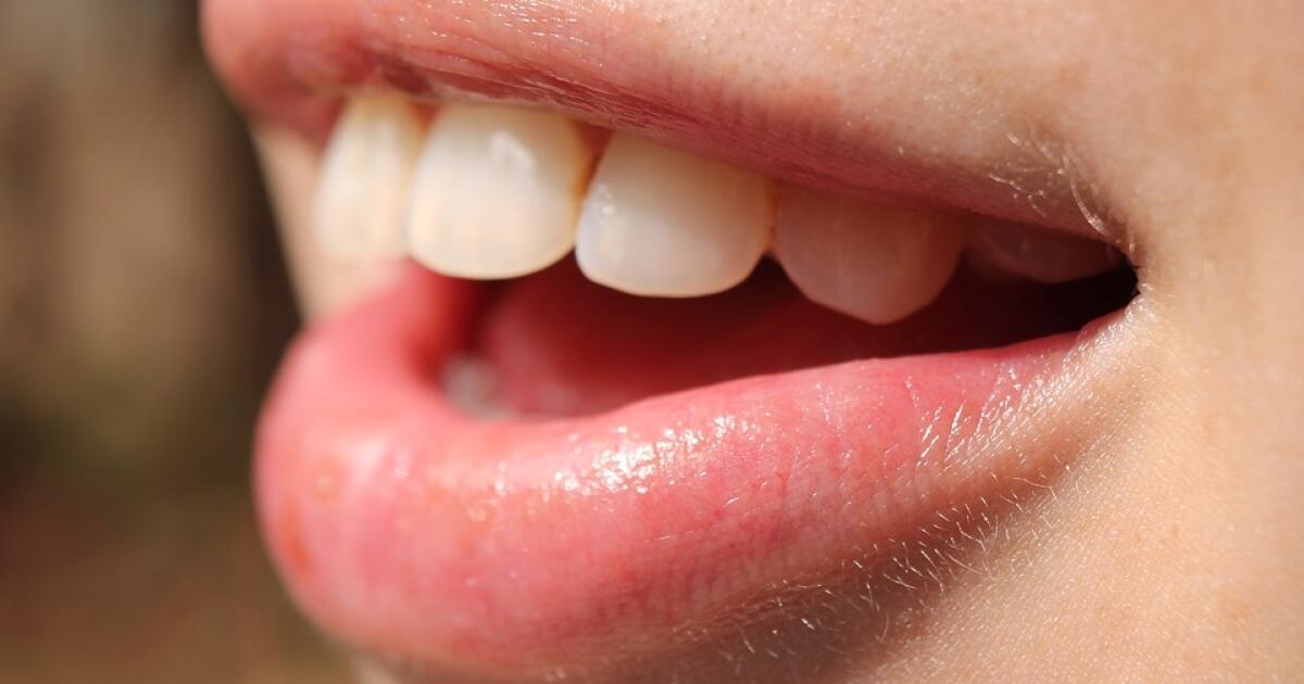 Uvazujete Nad Zubnym Implantatom Toto Musite Vediet K
