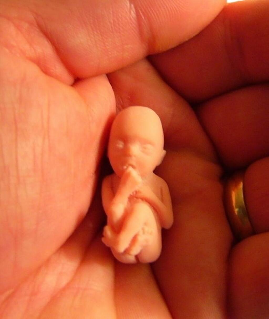 Ребёнок на 9 неделе беременности аборт