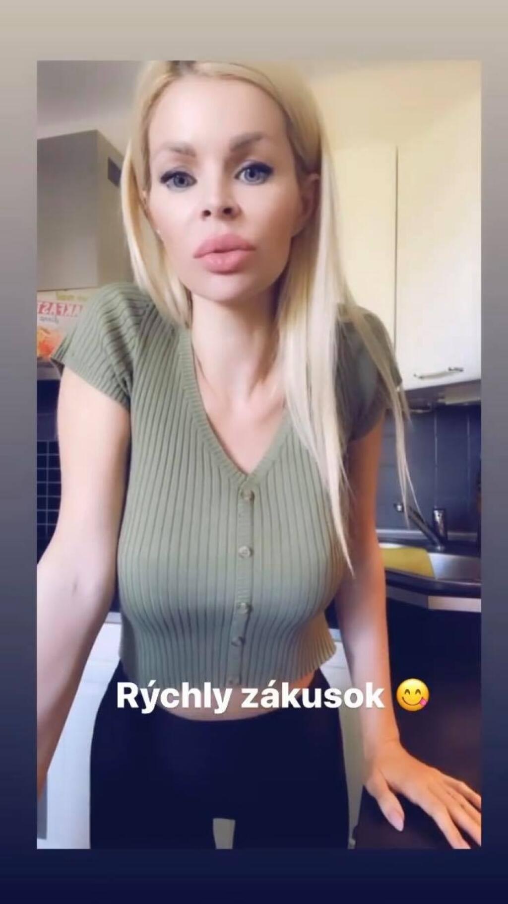 Prirodeznosť Silvii Kucherenko dlho nevydržala. Opäť má akési väčšie pery.